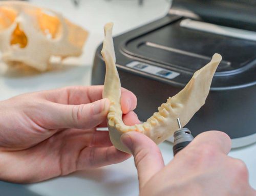 Így alakítja át a 3D technológia a fogászati kezeléseket